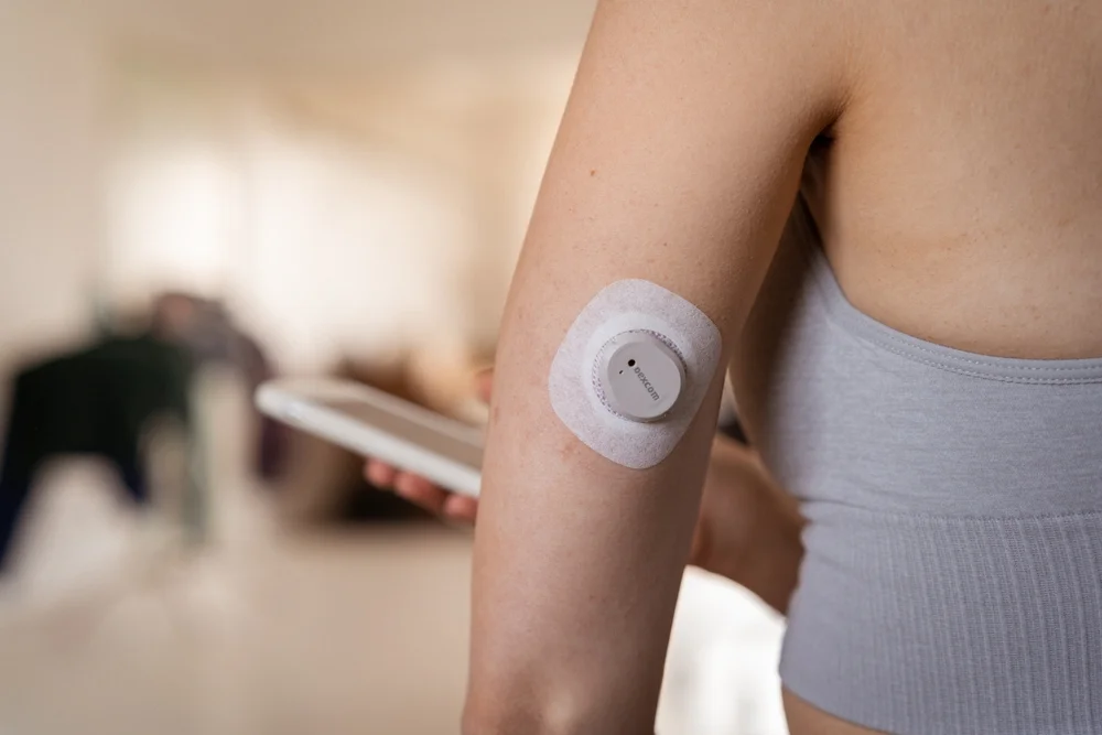 Dexcom continuous glucose monitor sensor on a person's upper arm